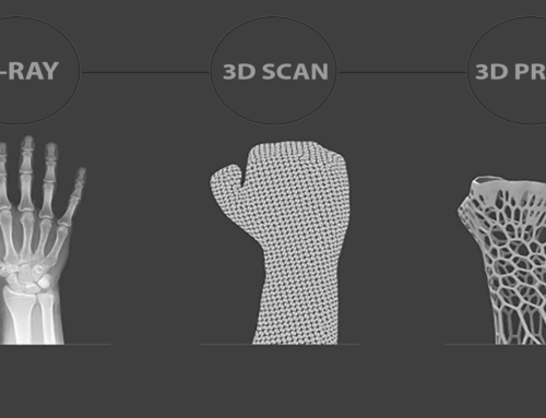کاربردهای چاپ سه بعدی در پزشکی